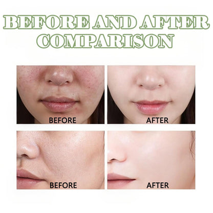 Purifying exfoliating Gel