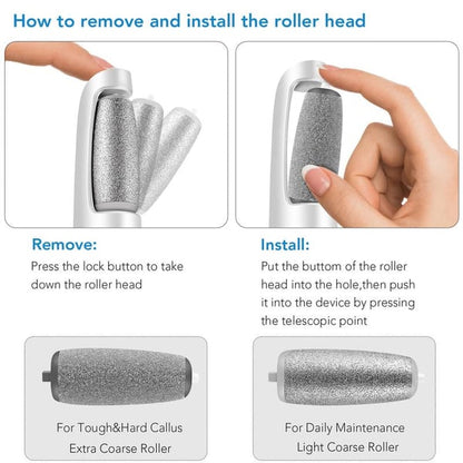 🔥Limited Time Sale - Get 30% Off🔥 Electric Feet Callus Remover 💖[+ FREE Head! 🎁]