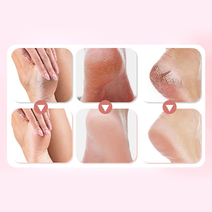🔥Limited Time Sale - Get 30% Off🔥 Electric Feet Callus Remover 💖[+ FREE Head! 🎁]